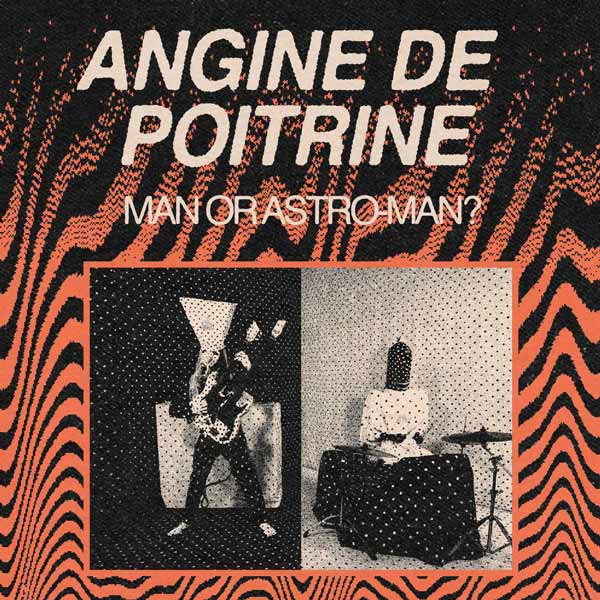 Angine De Poitrine