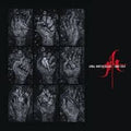Xmal Deutschland - Gift the 4AD Years 3xCD